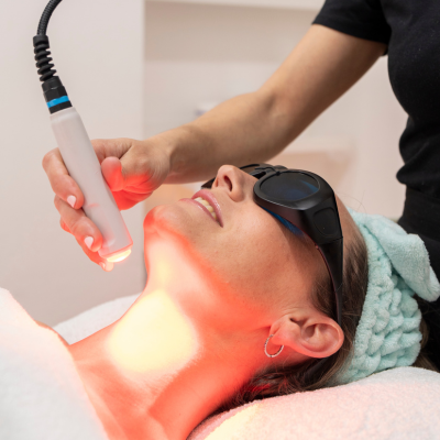 Radiofrecuencia facial