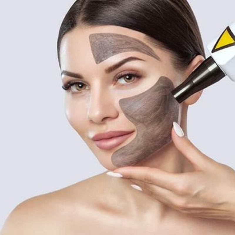 Tratamientos faciales